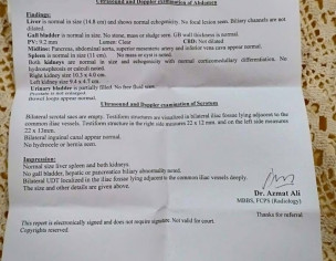 Undescended Testicles (both)