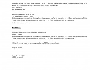 Conceive After Miscarriage