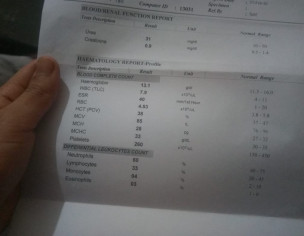 Swelling ,pain And Redness In One Foot