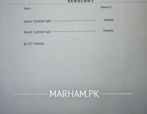 Typhoid Fever
