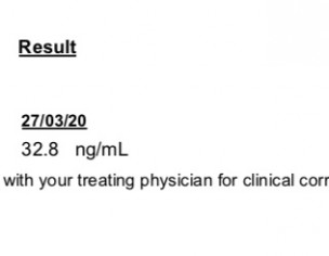 High Prolactin Level