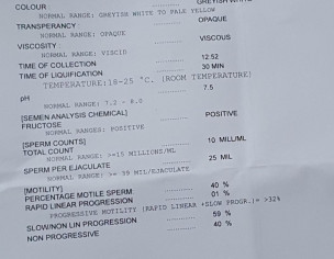 Semen Analysis 