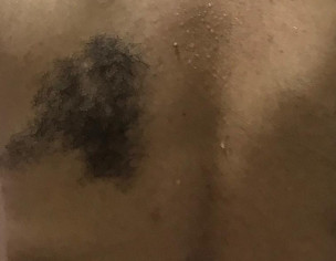 Skin Problem