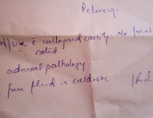 Lactation Amenorrhea