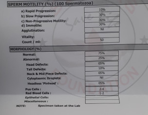 Sperm Analysis