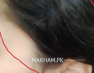 Headache Or Migrane Dont Know.