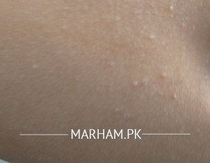 Skin Problems In Hot Weather