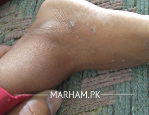 Skin Problems In Hot Weather