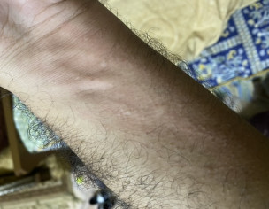 Itching With Bumps On Skin