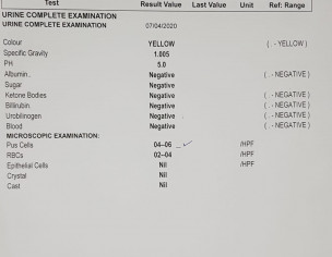 Night Fall - Prostatitis