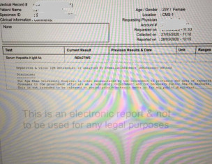 Problem Could Be Related To Liver