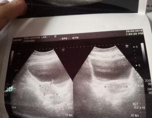 Gynaecological 