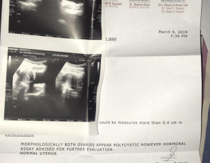 Menstrual Problem ( EDIT )