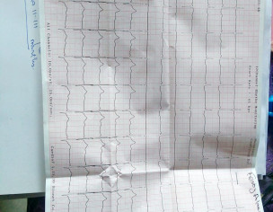 High BP, Anxiety, Sleeping Disorder