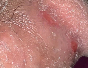 Dermatologist/sexologist 