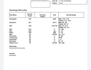 Fever, Weakness,Body Ache