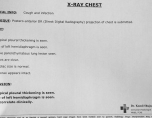 Cough And Breathing Problem 