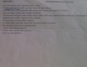 Mitral Valve Replacement Surgery