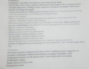 Obstructive Jaundice 