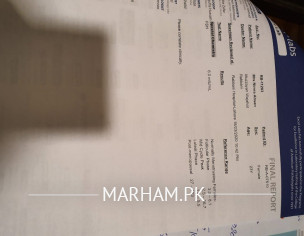 Irregular Periods After Marraige