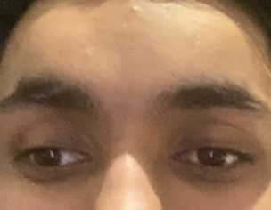 Eye Moves By Itself