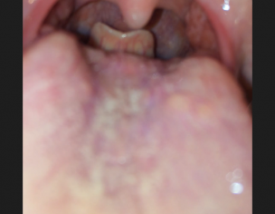 Oral Problem