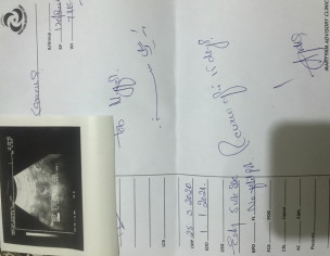 No Fetal Pole At 5 Weeks 