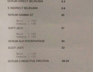 High Fever With Cough