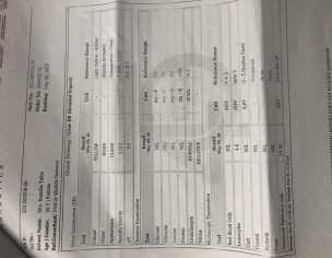Torch Test Reports Review
