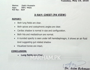 X-Ray Report