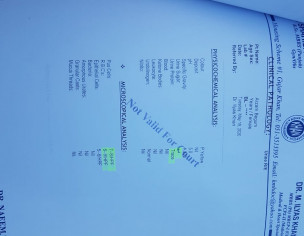 Typhoid, Vomiting, On And Off Temperature, 