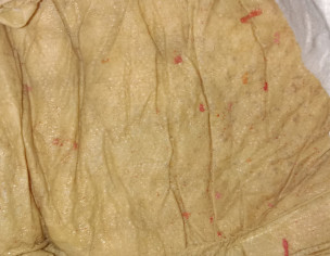 Red Particles In Motion 