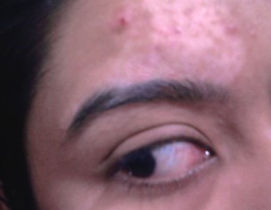 Unidentified Skin Problem