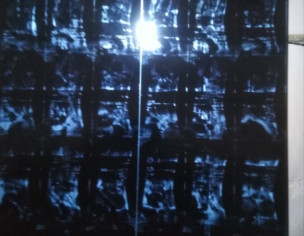 Completely Restricted Movement 