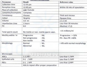 0% Sperm Count In SA Test