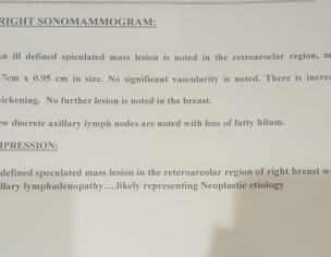 Ca Right Breast. Stage 4