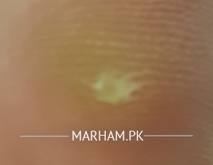 Problem Under My Feet