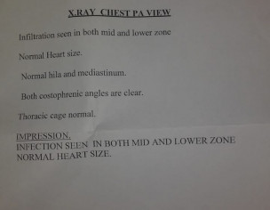 Chest Xray Indication