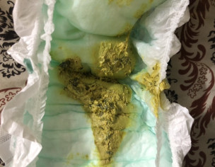 Black Specks In Poop