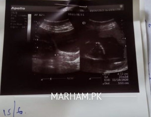 Pregnancy Issue -  Gynecologist