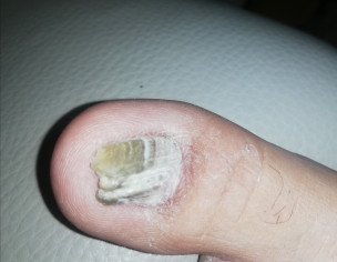 Thumb Nail