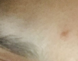 Eyebrows White Patche