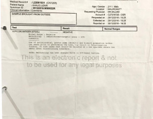 Moderate Pangastritis