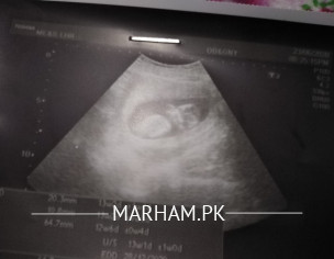 Pregnancy Suggestion