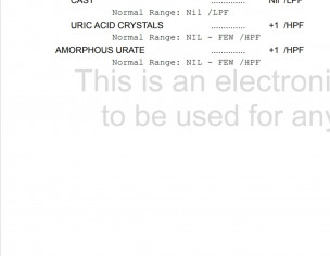 Urine D/R For Orange/red Stains