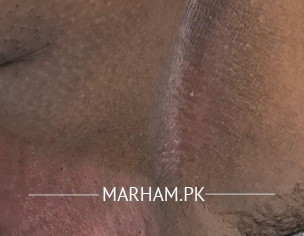 Skin Problem (dermatologist)