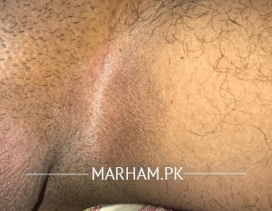 Skin Problem (dermatologist)