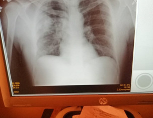 Sans Lana Main Problem