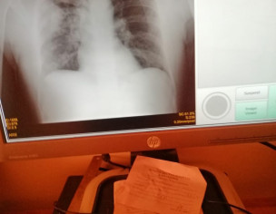 Sans Lana Main Problem