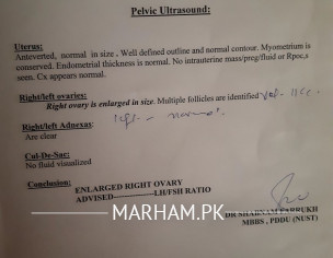 Less Cervical Mucus.